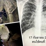 泰国专家：探树洞有风险！可能会被蝙蝠粪便中的携带病菌感染